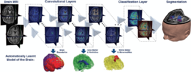 Figure 3 for Model-Based and Data-Driven Strategies in Medical Image Computing