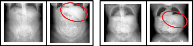 Figure 3 for PiNet: Deep Structure Learning using Feature Extraction in Trained Projection Space