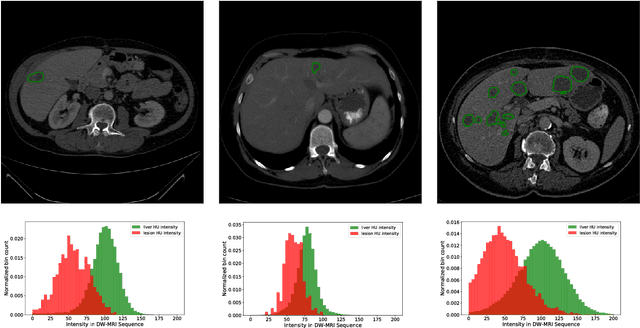 Figure 1 for The Liver Tumor Segmentation Benchmark (LiTS)