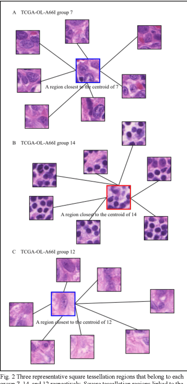 Figure 2 for Unsupervised Learning of Deep-Learned Features from Breast Cancer Images