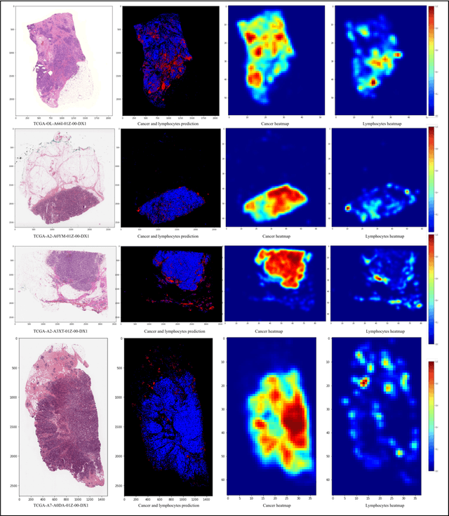 Figure 4 for Unsupervised Learning of Deep-Learned Features from Breast Cancer Images