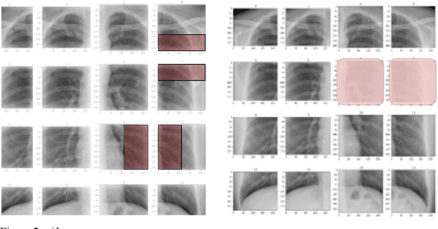 Figure 3 for A Deep Learning Based Workflow for Detection of Lung Nodules With Chest Radiograph