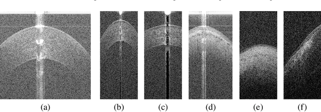 Figure 1 for Accurate Tissue Interface Segmentation via Adversarial Pre-Segmentation of Anterior Segment OCT Images