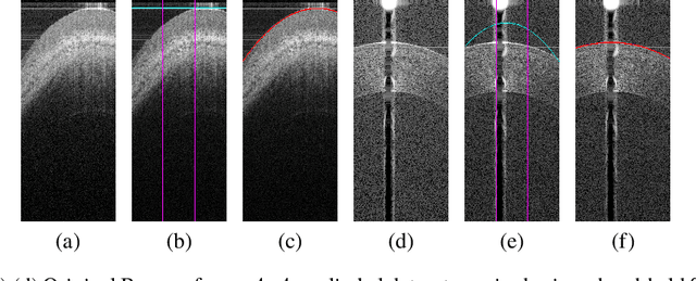 Figure 3 for Accurate Tissue Interface Segmentation via Adversarial Pre-Segmentation of Anterior Segment OCT Images