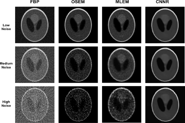 Figure 4 for SPECT Imaging Reconstruction Method Based on Deep Convolutional Neural Network