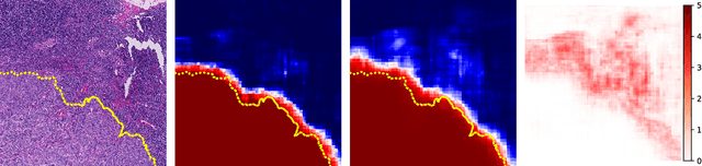 Figure 3 for Sample Efficient Semantic Segmentation using Rotation Equivariant Convolutional Networks