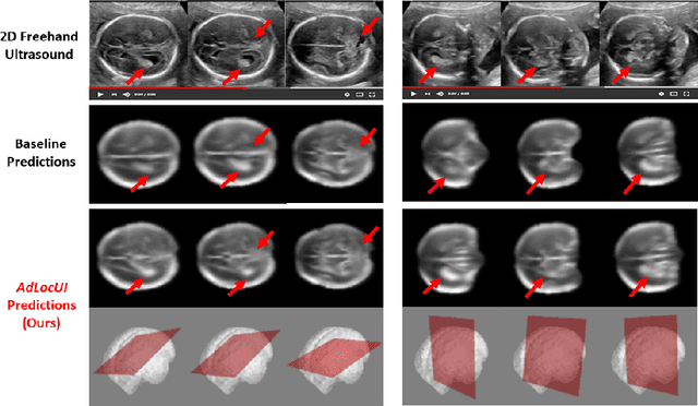 Figure 1 for Adaptive 3D Localization of 2D Freehand Ultrasound Brain Images