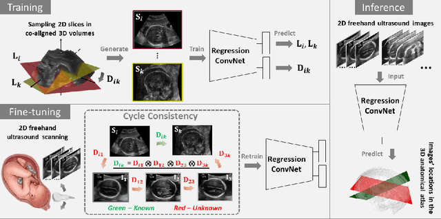 Figure 3 for Adaptive 3D Localization of 2D Freehand Ultrasound Brain Images