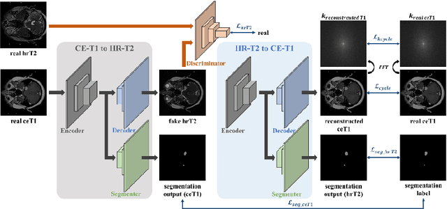 Figure 2 for Self-Training Based Unsupervised Cross-Modality Domain Adaptation for Vestibular Schwannoma and Cochlea Segmentation