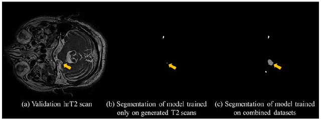 Figure 4 for Self-Training Based Unsupervised Cross-Modality Domain Adaptation for Vestibular Schwannoma and Cochlea Segmentation