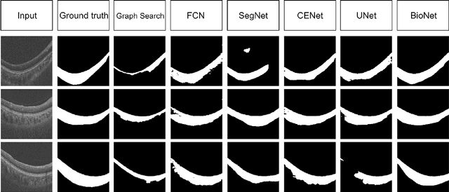 Figure 4 for BioNet: Infusing Biomarker Prior into Global-to-Local Network for Choroid Segmentation in Optical Coherence Tomography Images