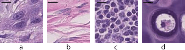 Figure 1 for Deconvolving convolution neural network for cell detection