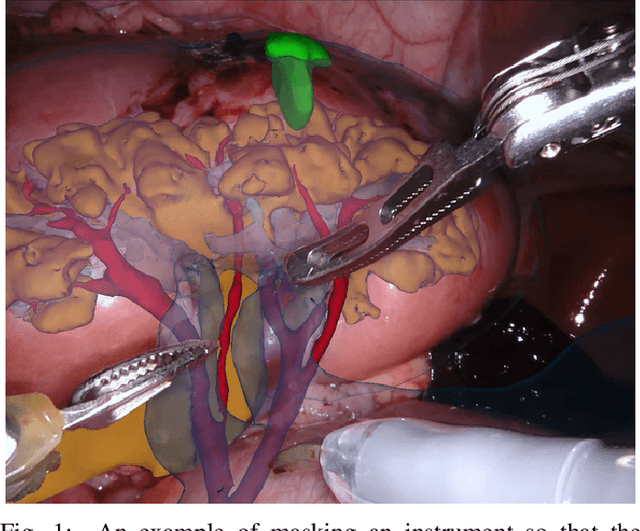 Figure 1 for 2017 Robotic Instrument Segmentation Challenge