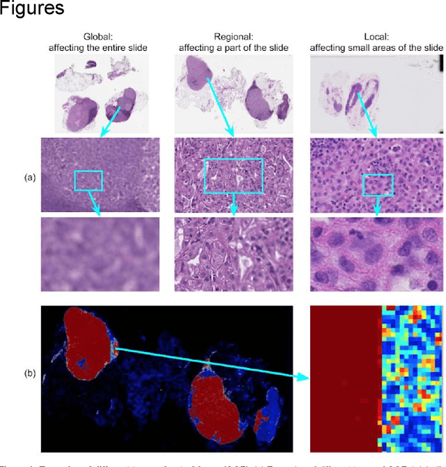 Figure 1 for Whole-Slide Image Focus Quality: Automatic Assessment and Impact on AI Cancer Detection