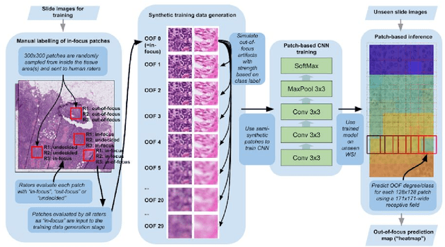 Figure 3 for Whole-Slide Image Focus Quality: Automatic Assessment and Impact on AI Cancer Detection