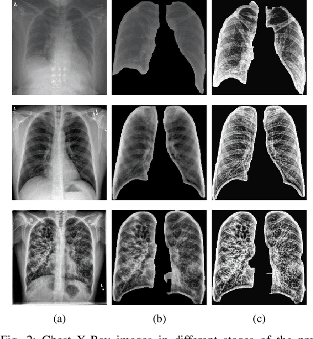 Figure 2 for Potential Features of ICU Admission in X-ray Images of COVID-19 Patients