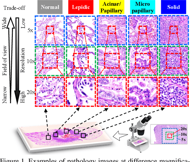 Figure 1 for Adaptive Weighting Multi-Field-of-View CNN for Semantic Segmentation in Pathology