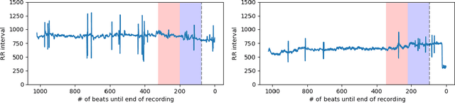 Figure 1 for Advance Prediction of Ventricular Tachyarrhythmias using Patient Metadata and Multi-Task Networks