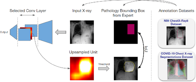 Figure 1 for Towards Semantic Interpretation of Thoracic Disease and COVID-19 Diagnosis Models