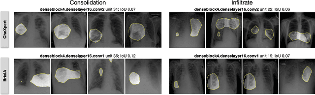 Figure 3 for Towards Semantic Interpretation of Thoracic Disease and COVID-19 Diagnosis Models