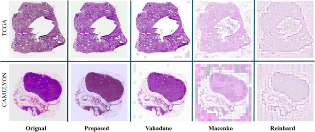 Figure 1 for Fast, Self Supervised, Fully Convolutional Color Normalization of H&E Stained Images