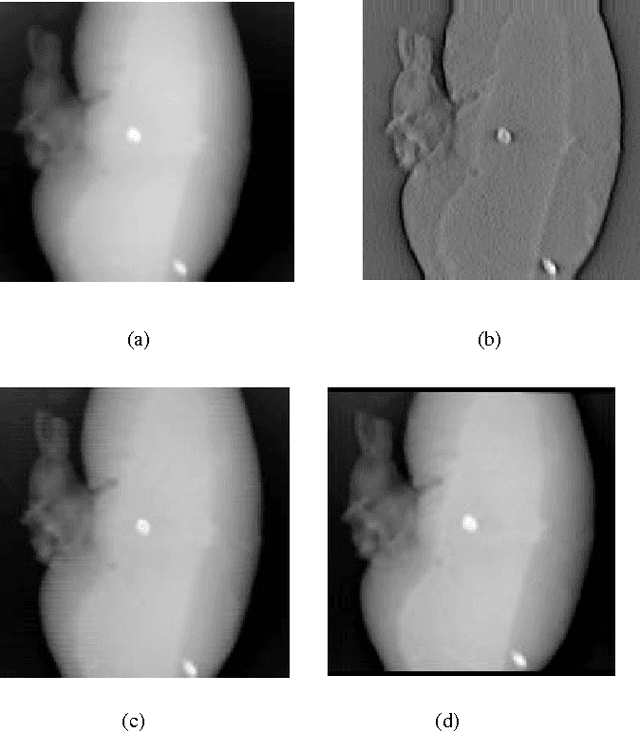 Figure 4 for C-arm Tomographic Imaging Technique for Nephrolithiasis and Detection of Kidney Stones