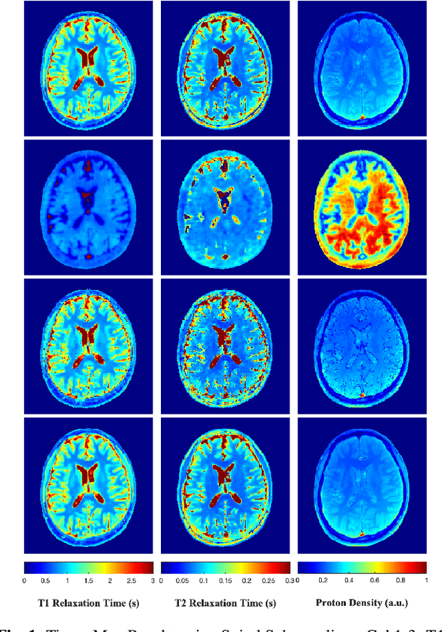 Figure 1 for A Plug-and-Play Approach to Multiparametric Quantitative MRI: Image Reconstruction using Pre-Trained Deep Denoisers