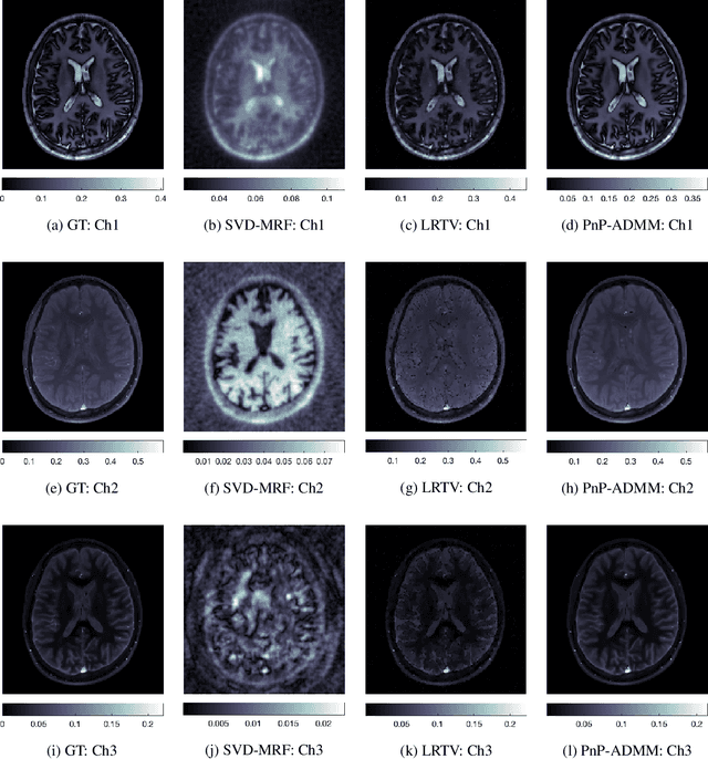 Figure 3 for A Plug-and-Play Approach to Multiparametric Quantitative MRI: Image Reconstruction using Pre-Trained Deep Denoisers