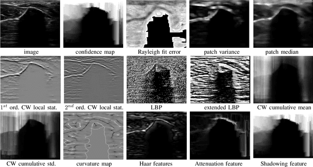 Figure 3 for Delineating Bone Surfaces in B-Mode Images Constrained by Physics of Ultrasound Propagation