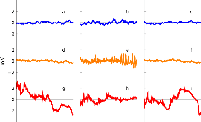 Figure 4 for Supervised Learning in Automatic Channel Selection for Epileptic Seizure Detection