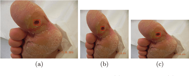 Figure 2 for DFUC2020: Analysis Towards Diabetic Foot Ulcer Detection