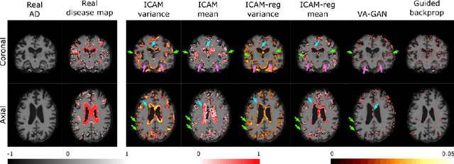 Figure 1 for ICAM-reg: Interpretable Classification and Regression with Feature Attribution for Mapping Neurological Phenotypes in Individual Scans