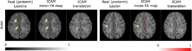 Figure 2 for ICAM-reg: Interpretable Classification and Regression with Feature Attribution for Mapping Neurological Phenotypes in Individual Scans