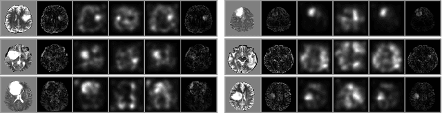 Figure 4 for Unsupervised Anomaly Localization using Variational Auto-Encoders