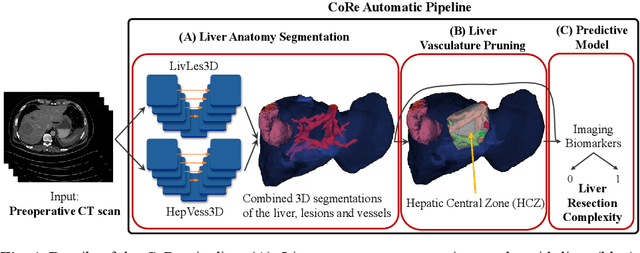 Figure 1 for CoRe: An Automated Pipeline for The Prediction of Liver Resection Complexity from Preoperative CT Scans