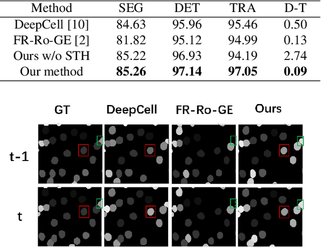 Figure 3 for CellTrack R-CNN: A Novel End-To-End Deep Neural Network for Cell Segmentation and Tracking in Microscopy Images