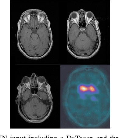 Figure 1 for A Unified Deep Learning Approach for Prediction of Parkinson's Disease