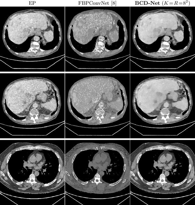 Figure 3 for BCD-Net for Low-dose CT Reconstruction: Acceleration, Convergence, and Generalization