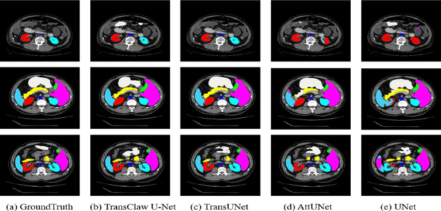 Figure 3 for TransClaw U-Net: Claw U-Net with Transformers for Medical Image Segmentation