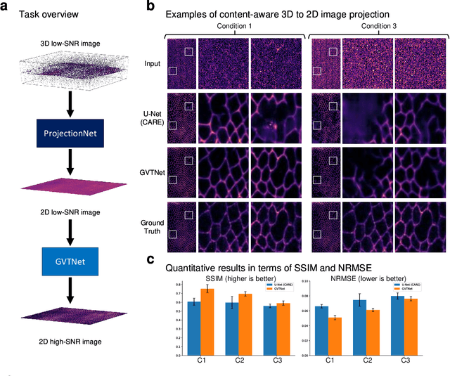 Figure 4 for Global Voxel Transformer Networks for Augmented Microscopy