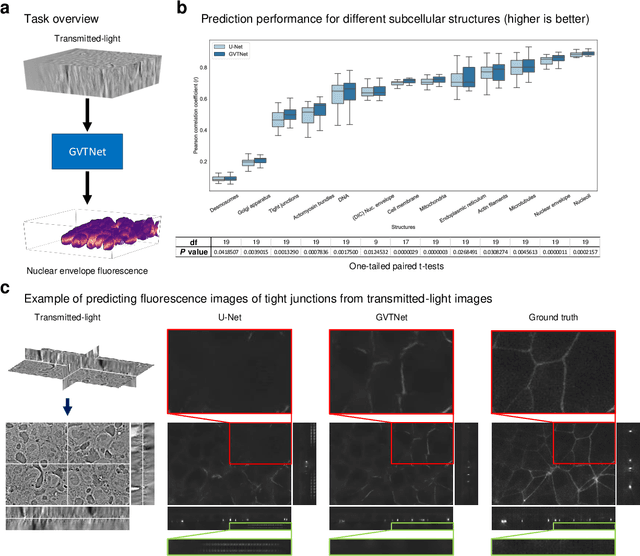 Figure 2 for Global Voxel Transformer Networks for Augmented Microscopy