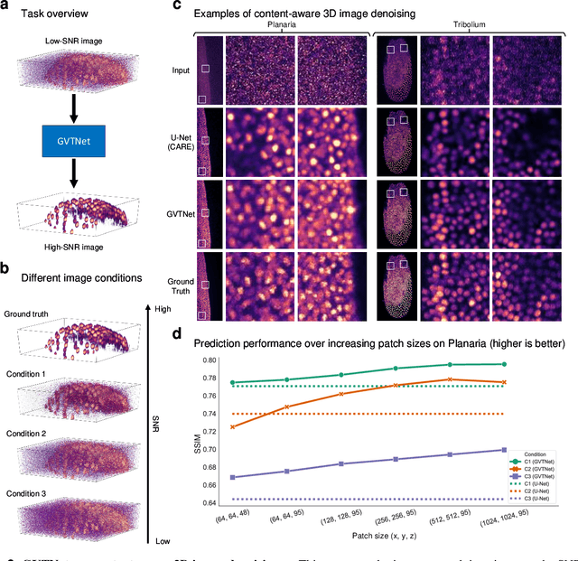 Figure 3 for Global Voxel Transformer Networks for Augmented Microscopy