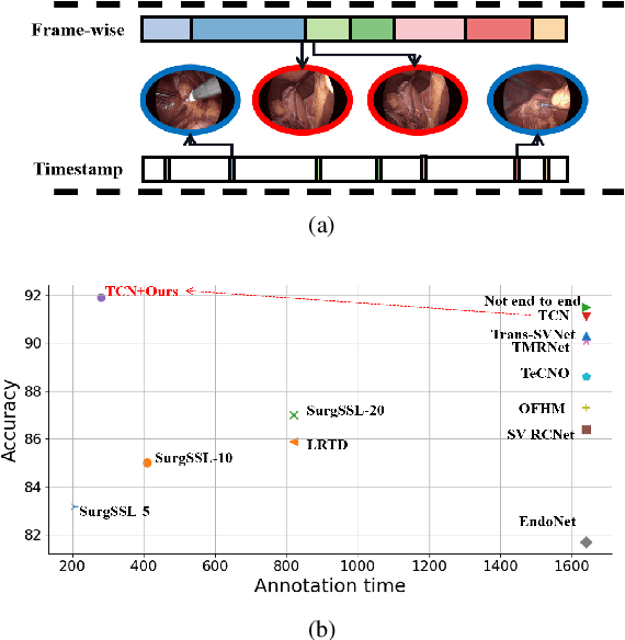 Figure 1 for Less is More: Surgical Phase Recognition from Timestamp Supervision