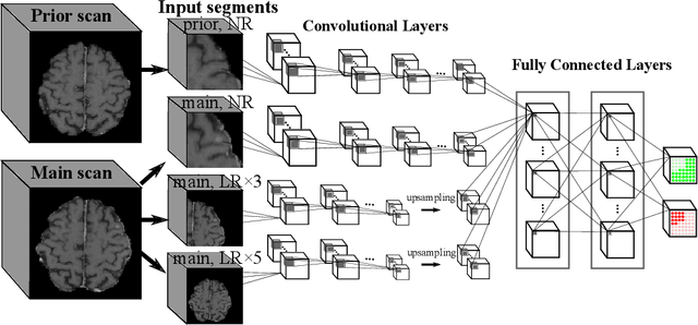 Figure 3 for Deep learning for brain metastasis detection and segmentation in longitudinal MRI data