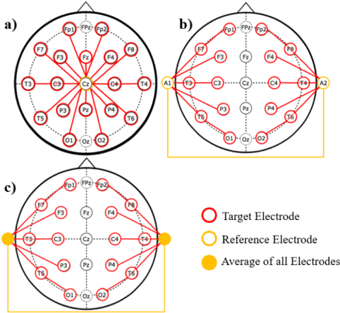 Figure 1 for An Analysis of Two Common Reference Points for EEGs