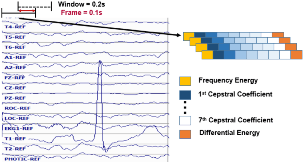Figure 3 for An Analysis of Two Common Reference Points for EEGs