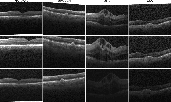 Figure 2 for SISE-PC: Semi-supervised Image Subsampling for Explainable Pathology