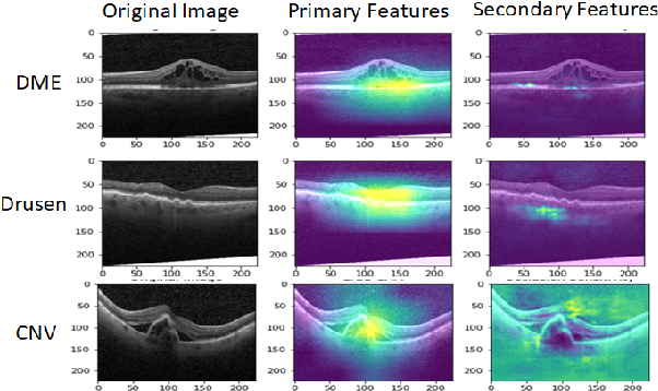 Figure 3 for SISE-PC: Semi-supervised Image Subsampling for Explainable Pathology