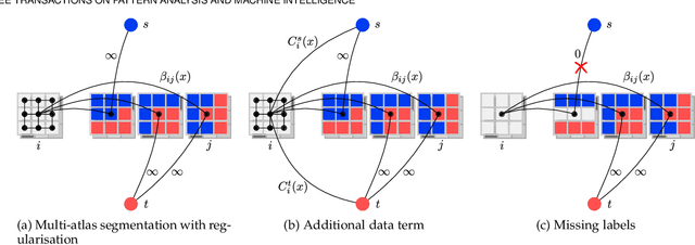 Figure 3 for Multi-Atlas Segmentation using Partially Annotated Data: Methods and Annotation Strategies