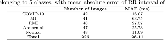 Figure 2 for Detecting COVID-19 from digitized ECG printouts using 1D convolutional neural networks